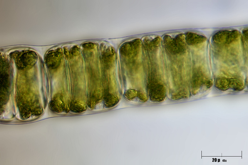 forse Microchaete sp. ? chi mi aiuta ?