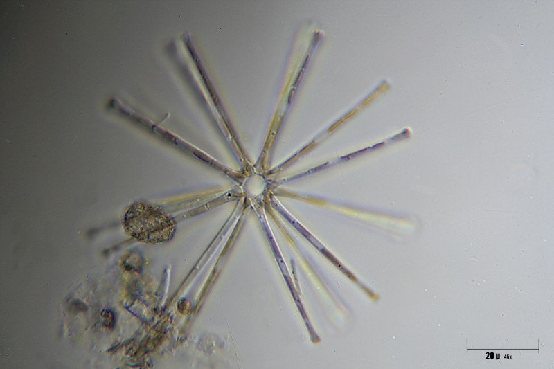 Asterionella formosa