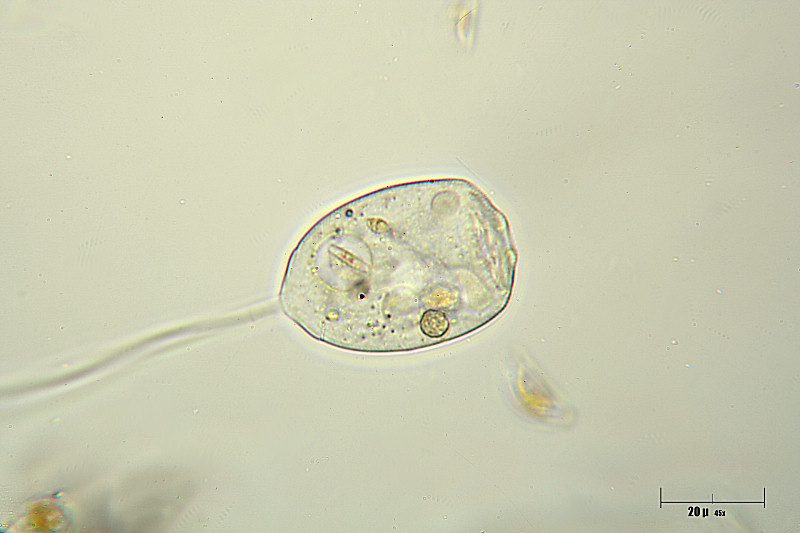 Vorticella sp. 2