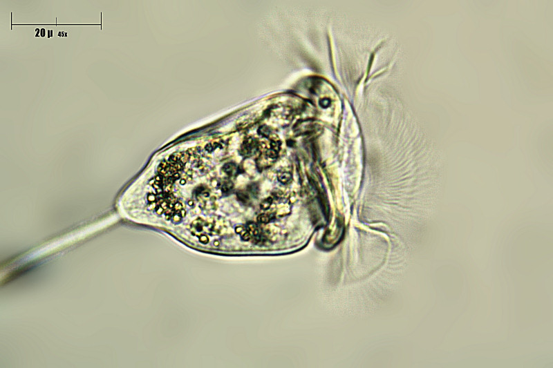 Vorticella sp.