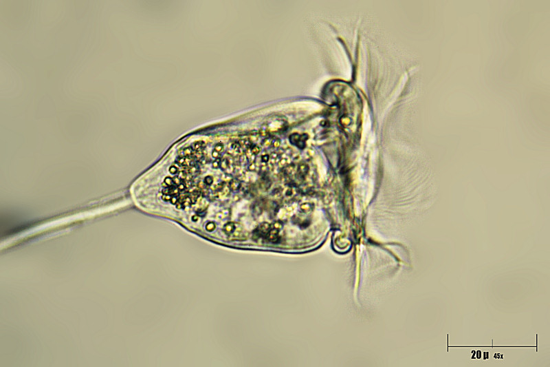 Vorticella sp.