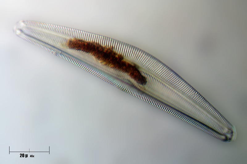 Cymbella sp.