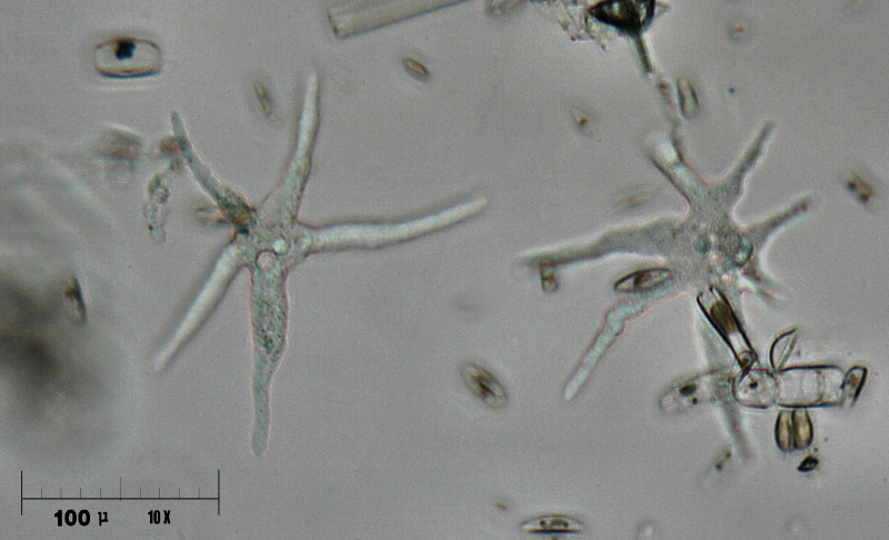 Amoeba gorgonia ?????