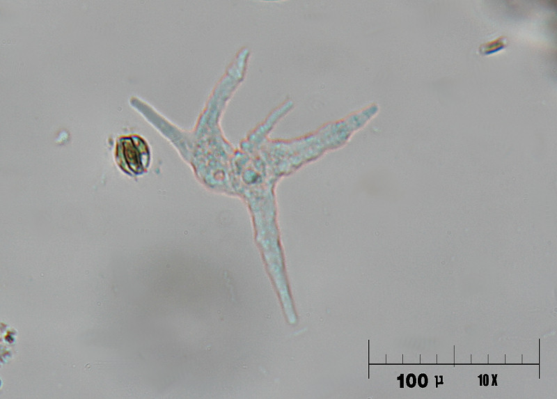 Amoeba gorgonia ?????