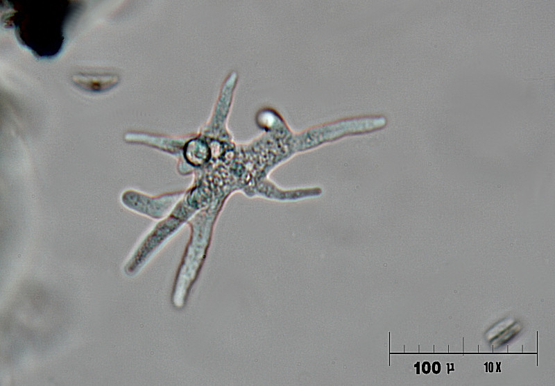 Amoeba gorgonia ?????