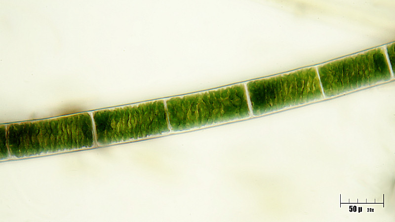 Spirogyra sp.