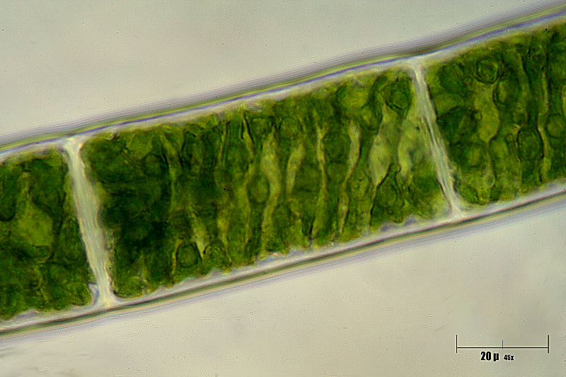 Spirogyra sp.