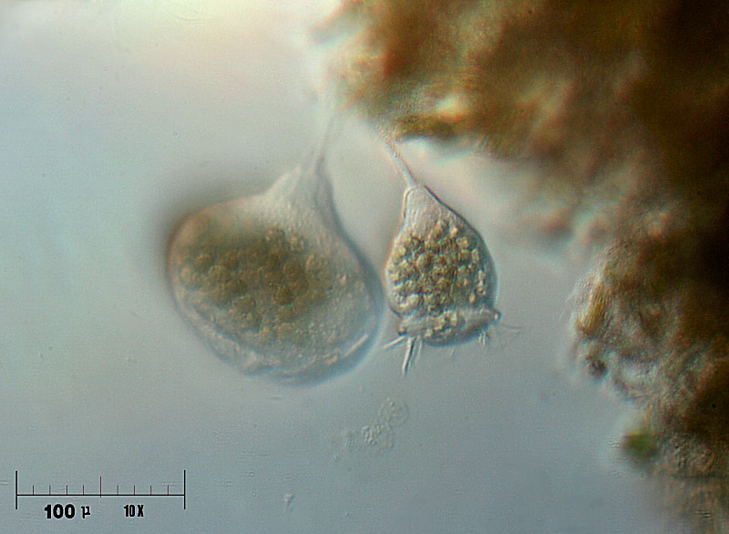 Vorticella e vorticellona