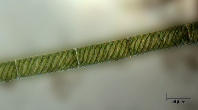 Spirogyra sp. - altra specie non identificabile