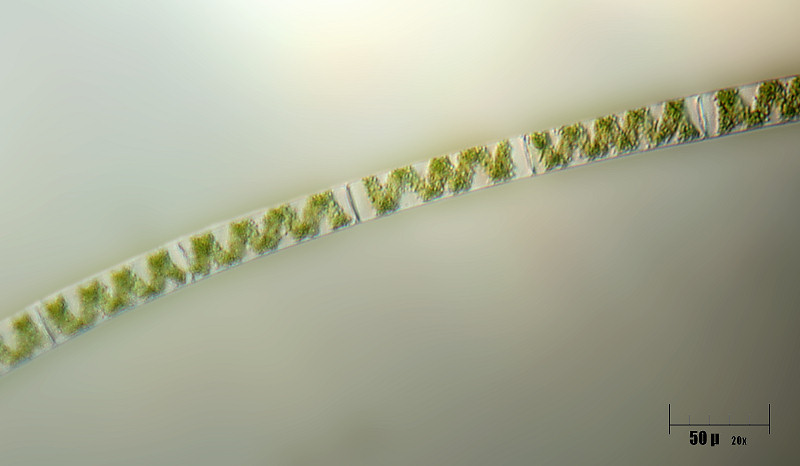 Spirogyra sp.