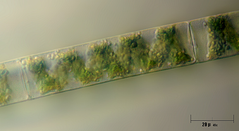 Spirogyra sp.