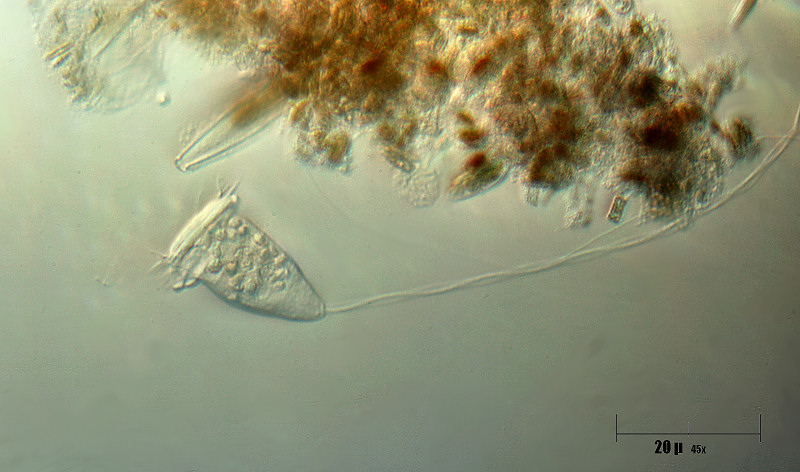 vorticella sp.