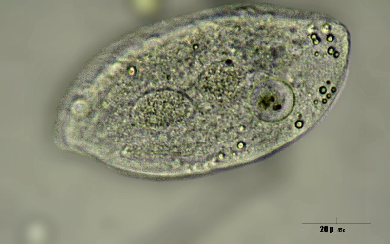 Paramecium sp. ???