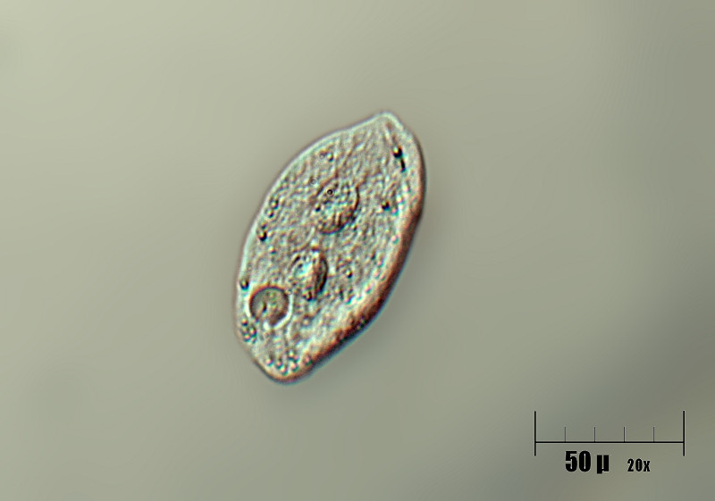 Paramecium sp. ???