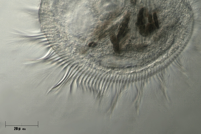 cilia di Stentor sp.