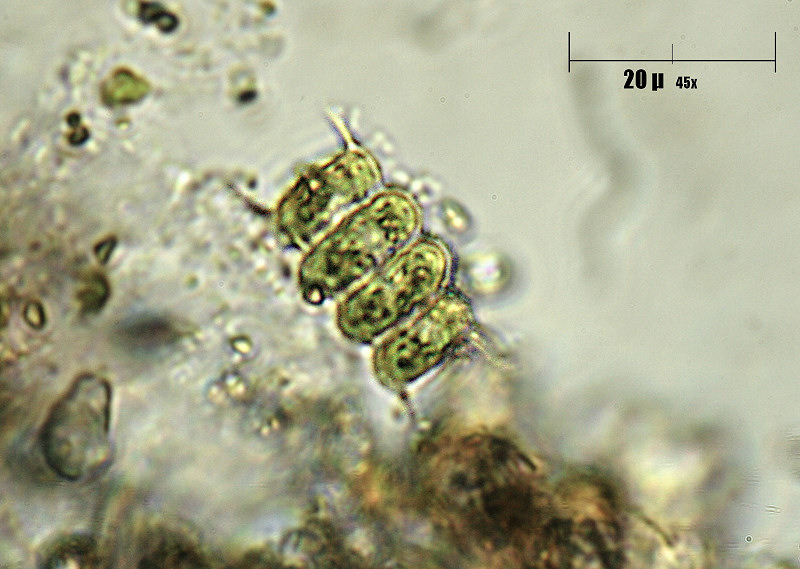 Scenedesmus quadricauda