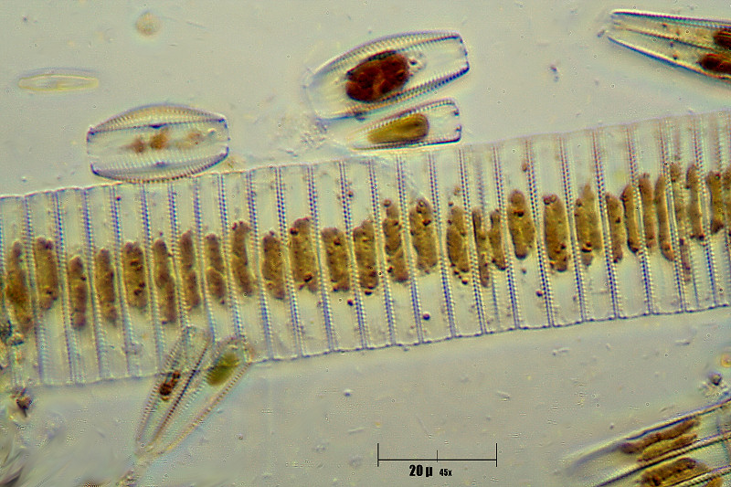 Fragilaria sp. o Diatoma sp. ?