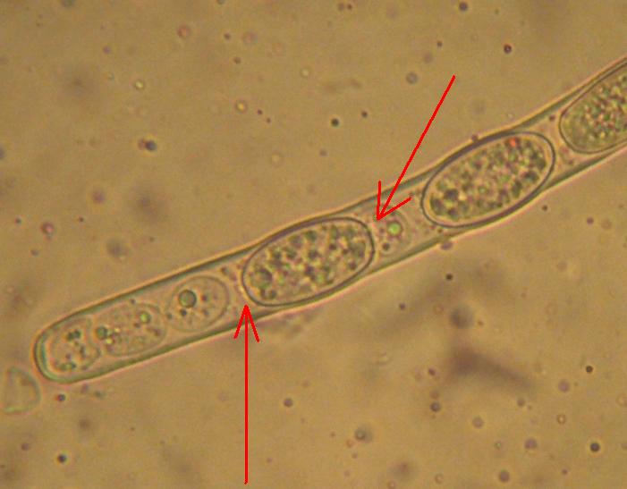 Sarcoscypha austriaca (?) con microscopia