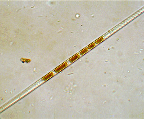 (2) Prime immagini al microscopio: batteri-protozoi-diatomee