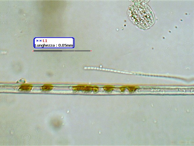 (2) Prime immagini al microscopio: batteri-protozoi-diatomee