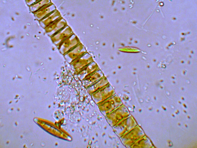 (2) Prime immagini al microscopio: batteri-protozoi-diatomee