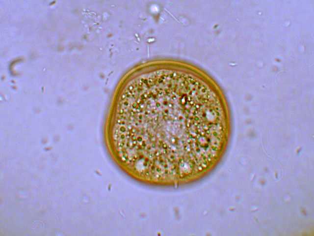 (3) Prime immagini al microscopio: batteri-protozoi-diatomee