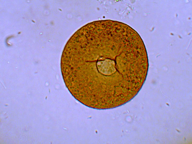 (3) Prime immagini al microscopio: batteri-protozoi-diatomee