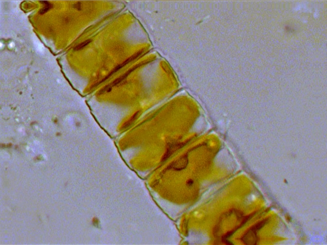 (3) Prime immagini al microscopio: batteri-protozoi-diatomee