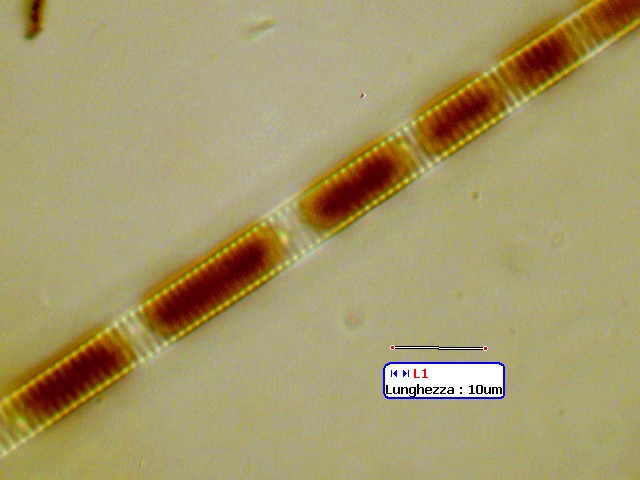 (3) Prime immagini al microscopio: batteri-protozoi-diatomee