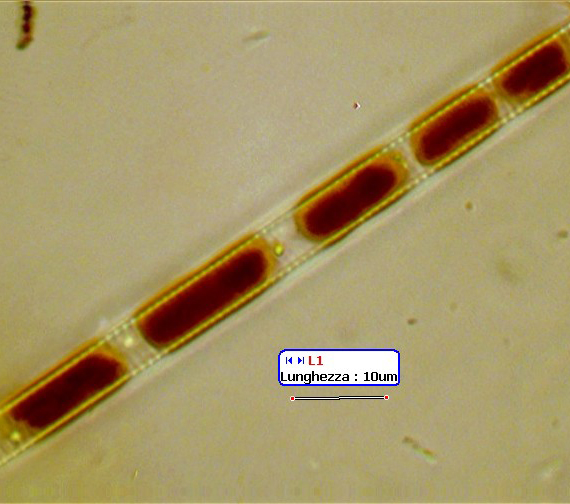 (3) Prime immagini al microscopio: batteri-protozoi-diatomee