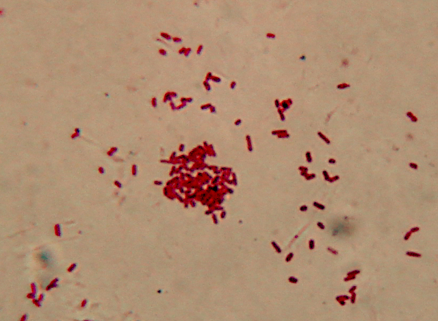 Prime immagini al microscopio: batteri - protozoi - diatomee