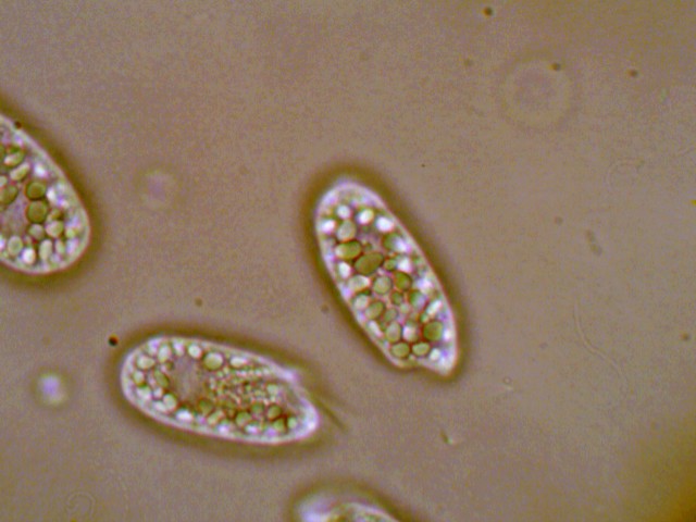 (4) Prime immagini al microscopio: batteri-protozoi-diatomee