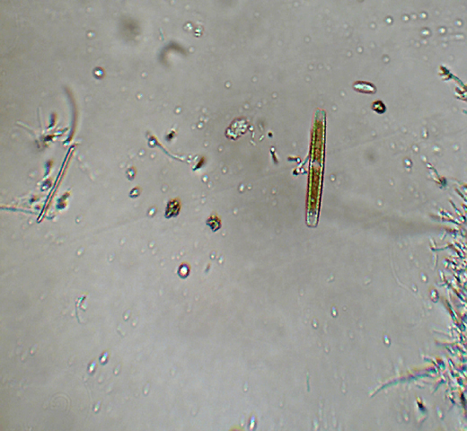 (4) Prime immagini al microscopio: batteri-protozoi-diatomee