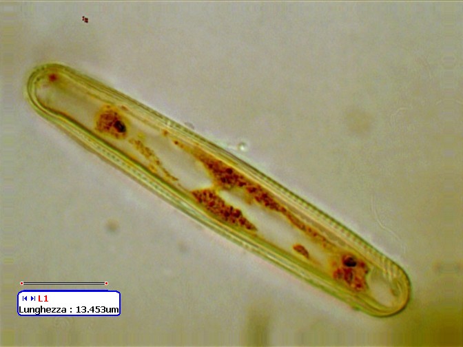 (2) Prime immagini al microscopio: batteri-protozoi-diatomee