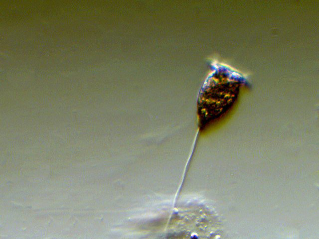 Vorticella