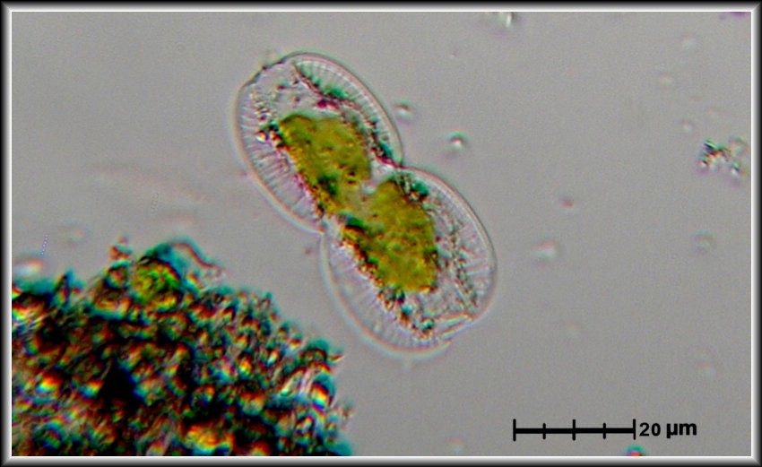 Diatomea: Amphiprora