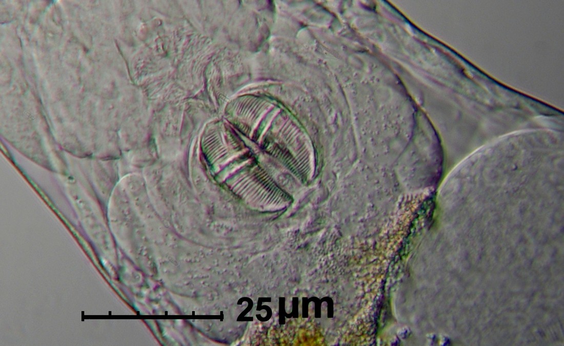 Mastax di Rotifero