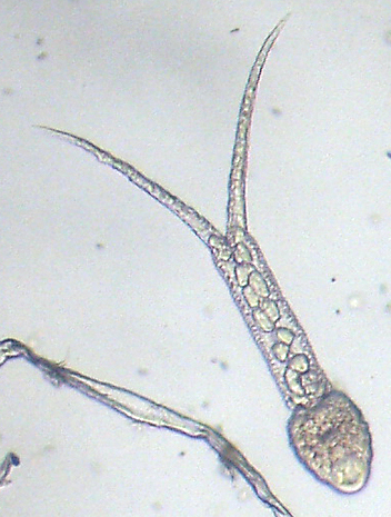 Trichobilharzia sp.