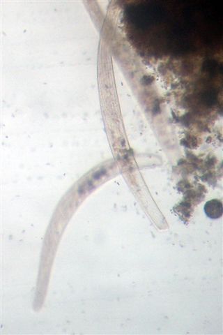 Trichobilharzia sp.