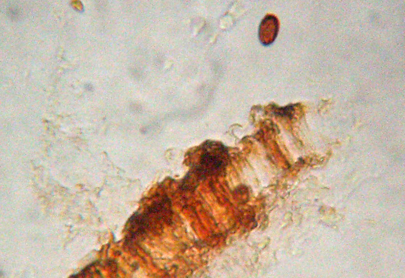 Aphyllophorales sotto la corteccia?