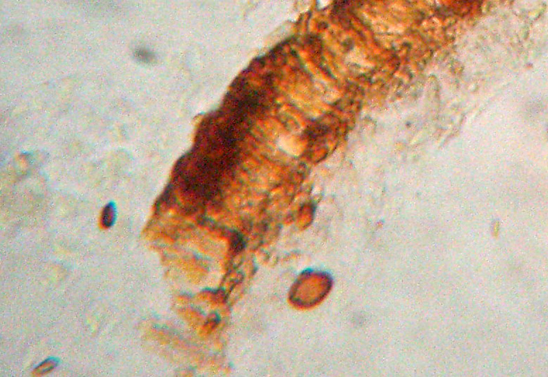 Aphyllophorales sotto la corteccia?