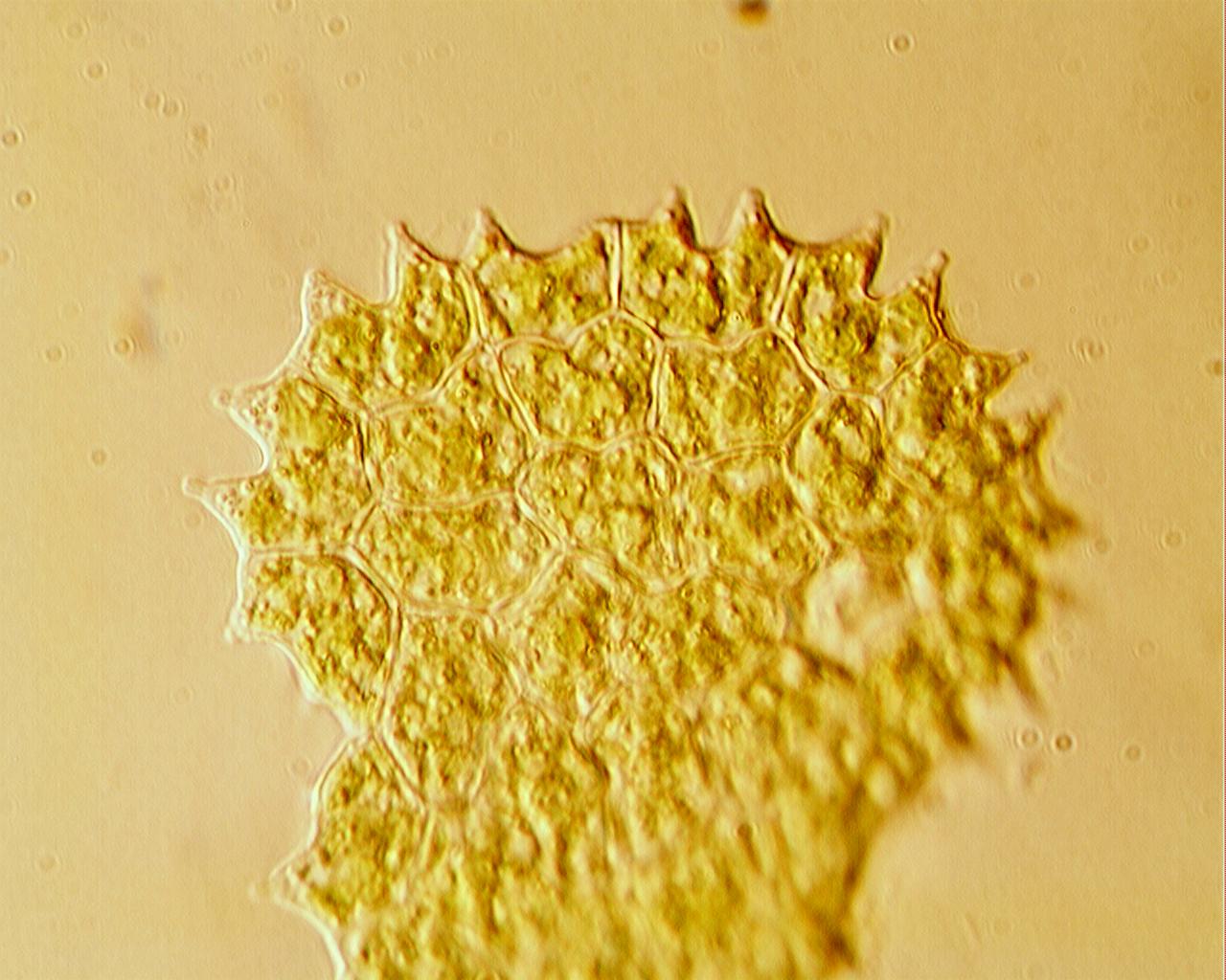 Pediastrum boryanum