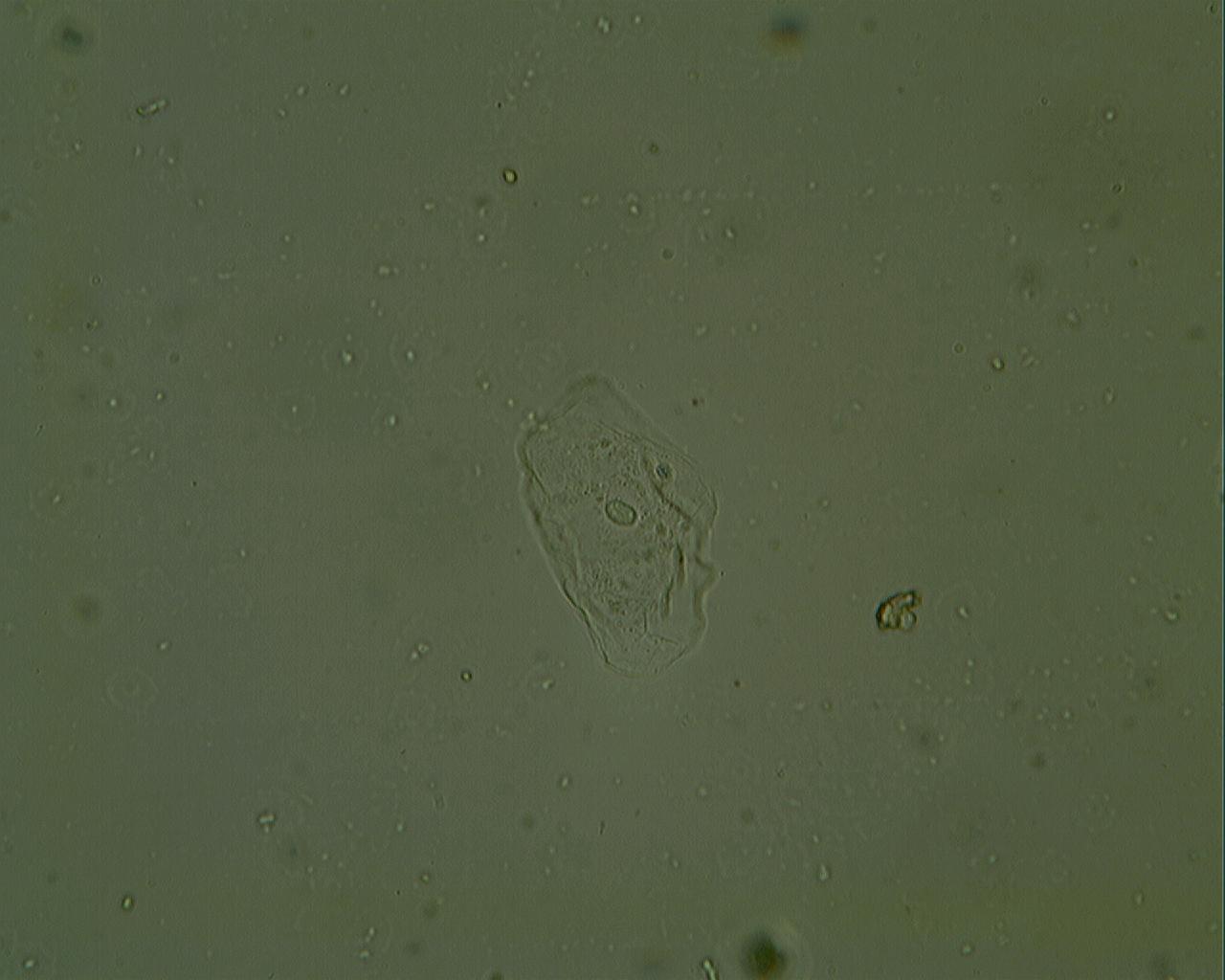 MISSIONE COMPIUTA !! - MICROSCOPIO ACQUISTATO