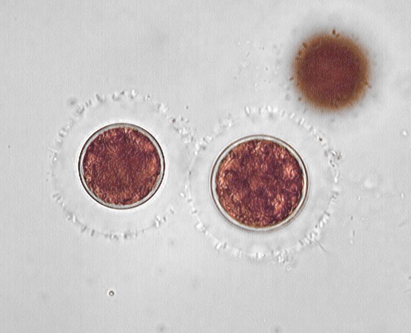 hematoccoccus