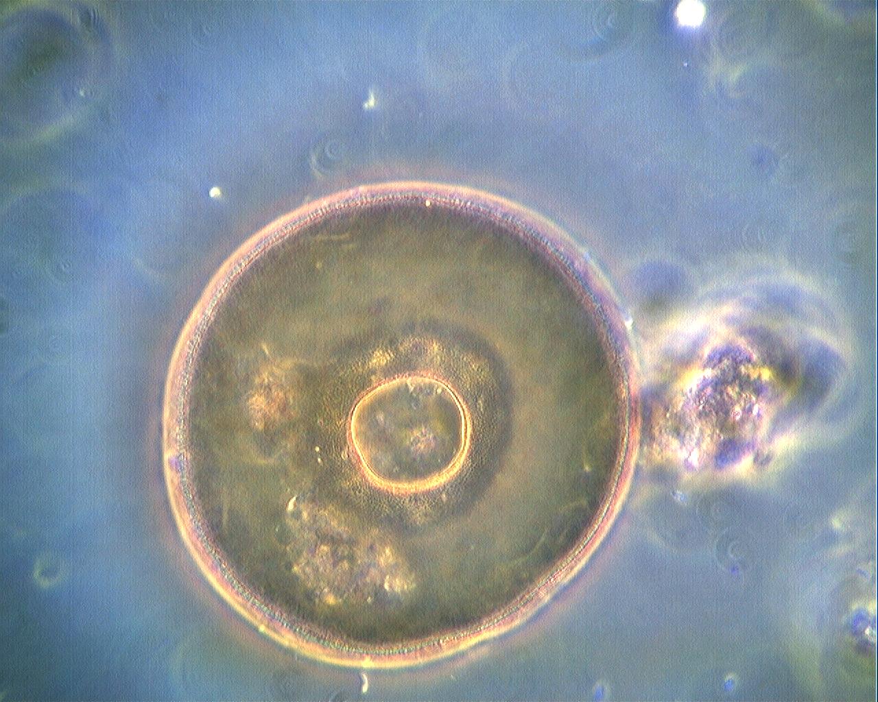 arcella campo scuro 400x 630x