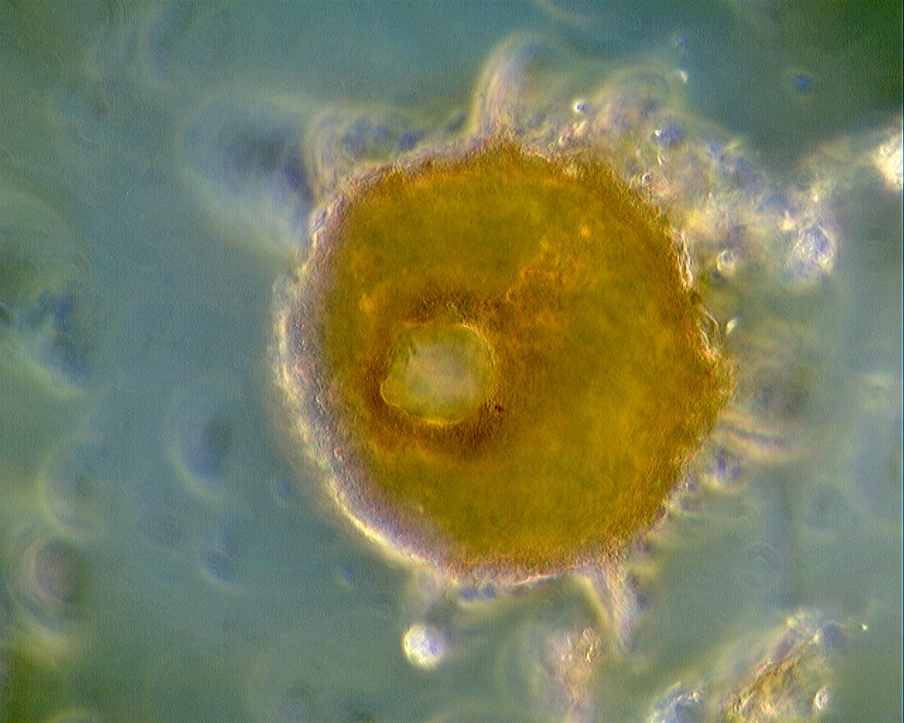 arcella campo scuro 400x 630x