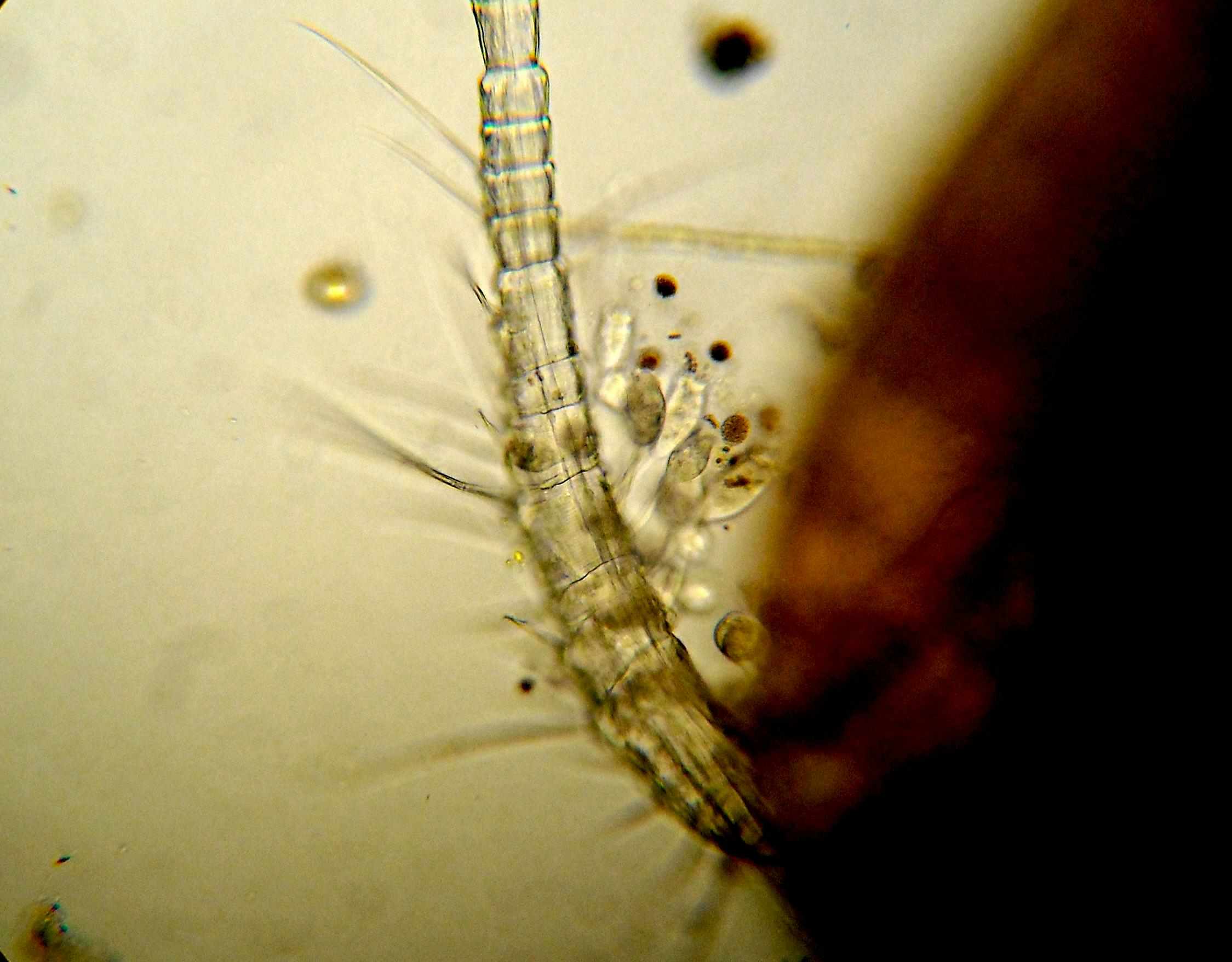 Copepode infestato da vorticelle?