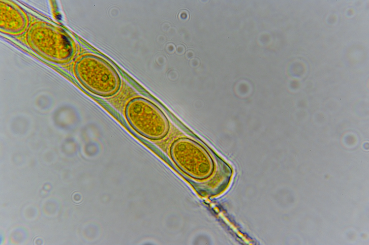 Ascomicete da det. (cfr. Pseudopithyella minuscula)