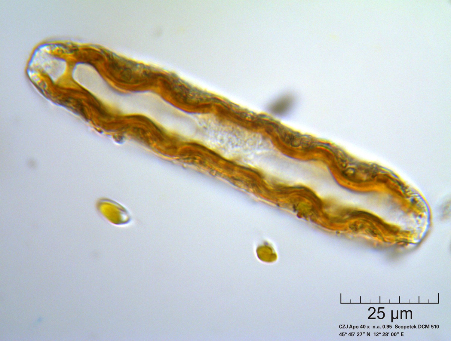 Diatomea - Cymatopleura solea