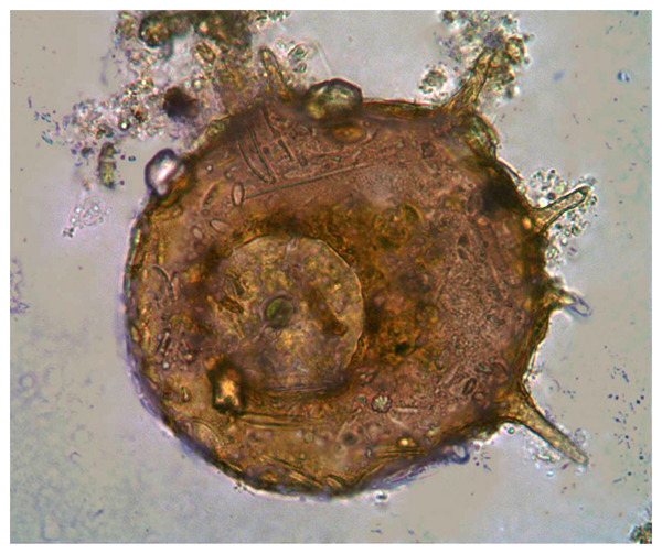 Quiz: Centropyxis aculeata